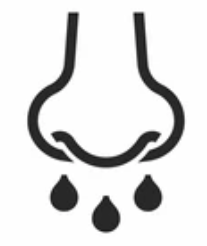 Anterior Cranial Base CSF Leaks and Encephaloceles